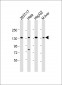 LRPPRC Antibody (Center)